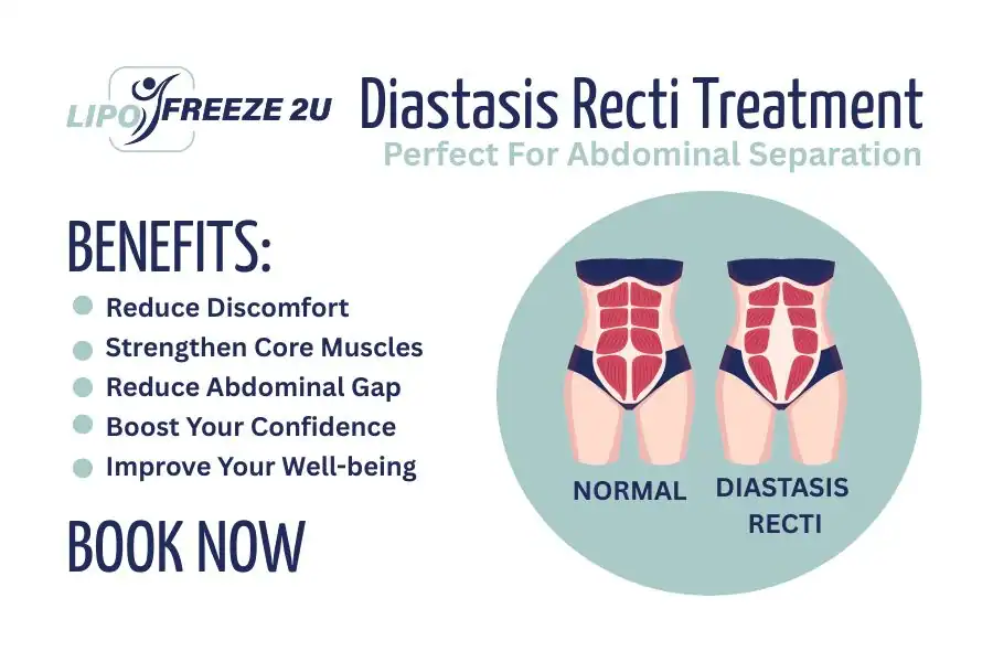 Benefits of body toning treatment Runnymede for Diastasis recti