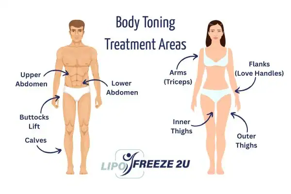 Graphic showing where you can have Body toning Treatment Runnymede on your body