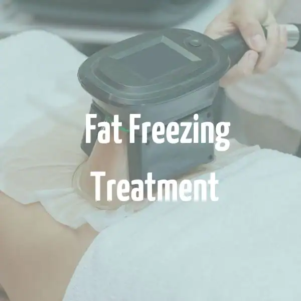 fat freezing treatment Runnymede